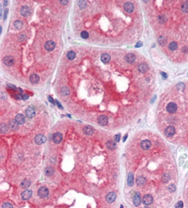 Anti-Prolyl Endopeptidase / PREP antibody, Internal used in IHC (Formalin-fixed paraffin-embedded sections). GTX89322