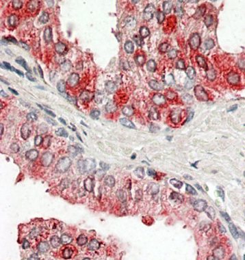 Anti-Prostatic Acid Phosphatase antibody, Internal used in IHC (Formalin-fixed paraffin-embedded sections). GTX88063
