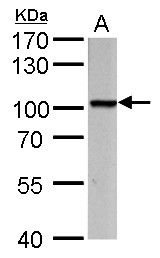Anti-PROX1 antibody used in Western blot. GTX129143