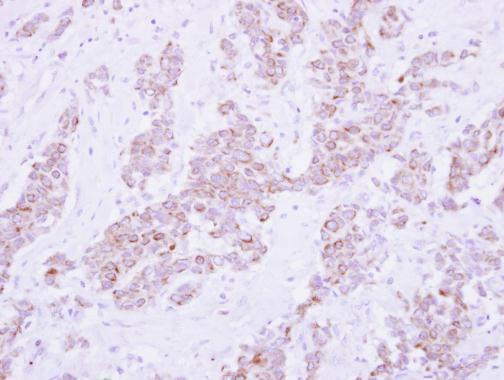 Anti-PSD4 antibody [C1C2], Internal used in IHC (Formalin-fixed paraffin-embedded sections). GTX121282