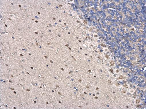 Anti-PSPC1 antibody used in IHC (Formalin-fixed paraffin-embedded sections). GTX119744