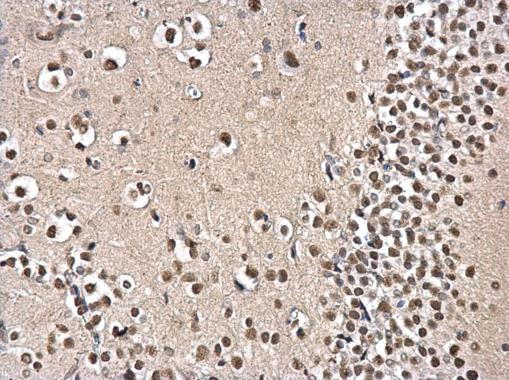 Anti-PSPC1 antibody used in IHC (Formalin-fixed paraffin-embedded sections). GTX119744