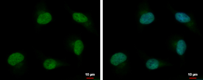 Anti-PSPC1 antibody used in ICC/IF. GTX119744