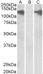 Anti-PUM2 antibody, Internal used in Western blot. GTX89543