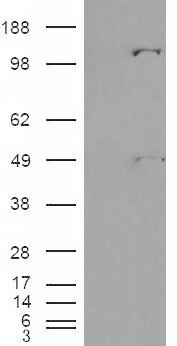 Anti-Pyruvate Carboxylase antibody, Internal used in Western blot. GTX88823
