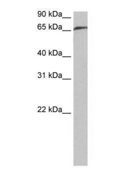 Anti-RABGGTA antibody, N-term used in Western blot. GTX46117