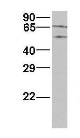 Anti-RABGGTA antibody, N-term used in Western blot. GTX46117