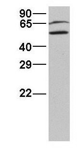 Anti-RABGGTA antibody, N-term used in Western blot. GTX46117