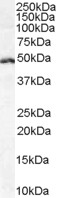 Anti-Rabring 7 / BCA2 antibody, Internal used in Western blot. GTX89285