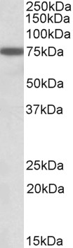 Anti-RACGAP1 / MgcRacGAP antibody, C-term used in Western blot. GTX89944