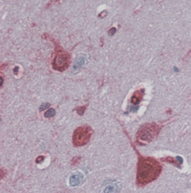Anti-RAE1 antibody, C-term used in IHC (Formalin-fixed paraffin-embedded sections). GTX89517