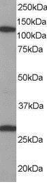 Anti-RANBP7 / Importin 7 antibody, C-term used in Western blot. GTX15840