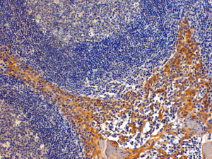 Anti-RANBP8 / IPO8 antibody, C-term used in IHC (Formalin-fixed paraffin-embedded sections). GTX25263