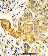 Anti-RARS2 antibody, C-term used in IHC (Formalin-fixed paraffin-embedded sections). GTX81155