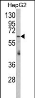 Anti-RARS2 antibody, C-term used in Western blot. GTX81155