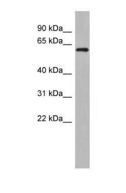 Anti-RBM47 antibody, Internal used in Western blot. GTX47272