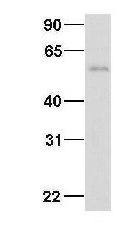 Anti-RBM47 antibody, Internal used in Western blot. GTX47272