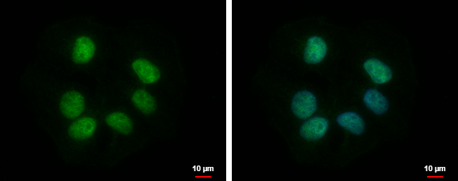 Anti-RBMY1F antibody used in ICC/IF. GTX122973