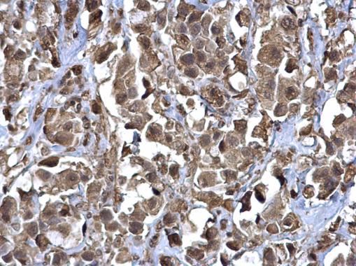 Anti-RERG antibody used in IHC (Formalin-fixed paraffin-embedded sections). GTX117011