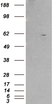 Anti-Retinoid X Receptor beta antibody, Internal used in Western blot. GTX89670