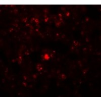 Anti-RHBDD2 antibody used in ICC/IF. GTX85219