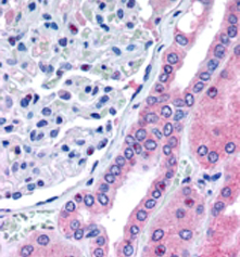 Anti-Rhophilin 2 antibody, Internal used in IHC (Formalin-fixed paraffin-embedded sections). GTX89485