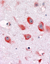 Anti-Ribosomal protein L22 antibody, C-term used in IHC (Formalin-fixed paraffin-embedded sections). GTX88916