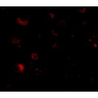 Anti-Rim2 antibody used in ICC/IF. GTX85035
