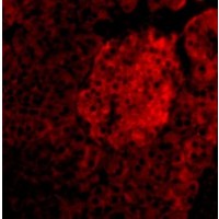 Anti-IL-23 antibody used in ICC/IF. GTX85495