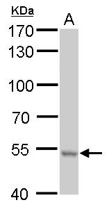 Anti-RNPEPL1 antibody used in Western blot. GTX111563