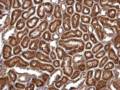 Anti-RNPEPL1 antibody used in IHC (Formalin-fixed paraffin-embedded sections). GTX111563