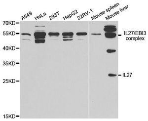 Anti-IL27 antibody used in Western blot. GTX54307