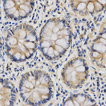 Anti-IL27 antibody used in IHC (Formalin-fixed paraffin-embedded sections). GTX54307