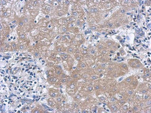 Anti-IL27 antibody [N1C3-2] used in IHC (Formalin-fixed paraffin-embedded sections). GTX119293