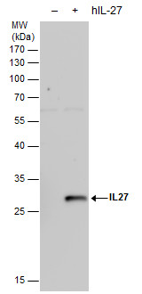 Anti-IL27 antibody [N1C3-2] used in Western blot. GTX119293