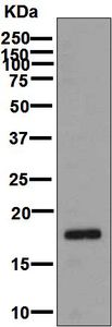 Anti-IL-28 antibody [EPR5328(2)] used in Western blot. GTX63858