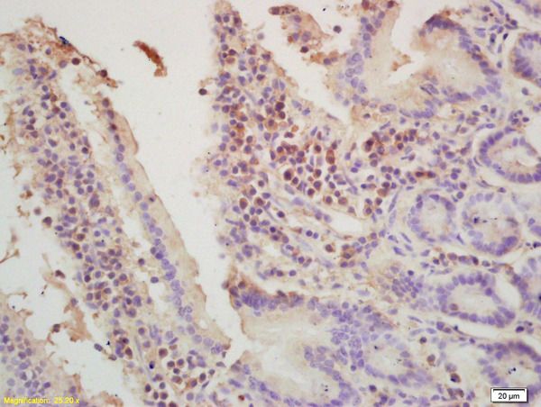 Anti-IL-28A antibody used in IHC (Formalin-fixed paraffin-embedded sections). GTX51540