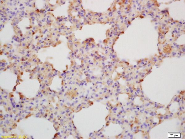 Anti-IL-28A antibody used in IHC (Formalin-fixed paraffin-embedded sections). GTX51540