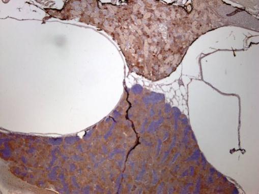 Anti-Rpl3 antibody used in IHC (Formalin-fixed paraffin-embedded sections). GTX124464
