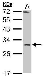Anti-RPP30 antibody [N1C3] used in Western blot. GTX117754