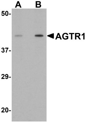 Anti-AGTR1 antibody used in Western blot. GTX31793