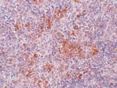 Anti-AGTR1 antibody used in Immunohistochemistry. GTX31793