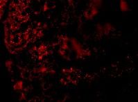 Anti-AGTR1 antibody used in ICC/IF. GTX31793