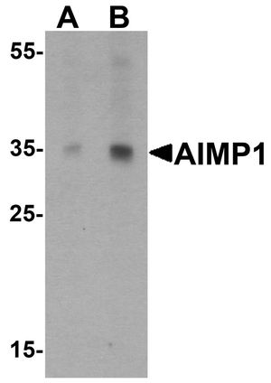 Anti-AIMP1 antibody used in Western blot. GTX31557