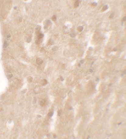 Anti-AIMP1 antibody used in Immunohistochemistry. GTX31557
