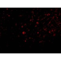 Anti-IL-32 antibody used in ICC/IF. GTX85070