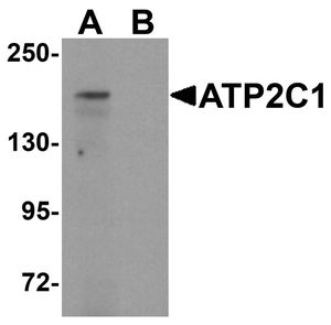 Anti-ATP2C1 antibody used in Western blot. GTX31834