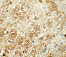 Anti-ATP2C1 antibody used in Immunohistochemistry. GTX31834