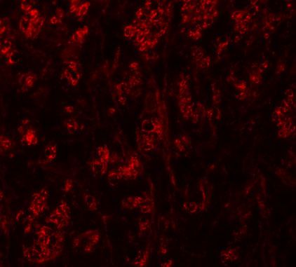 Anti-ATP2C1 antibody used in ICC/IF. GTX31834