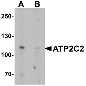 Anti-ATP2C2 antibody used in Western blot. GTX32009